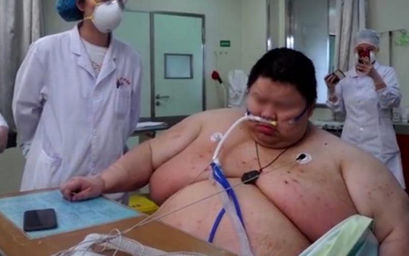 Hombre aumentó 100 kilos tras meses en cuarentena por COVID-19