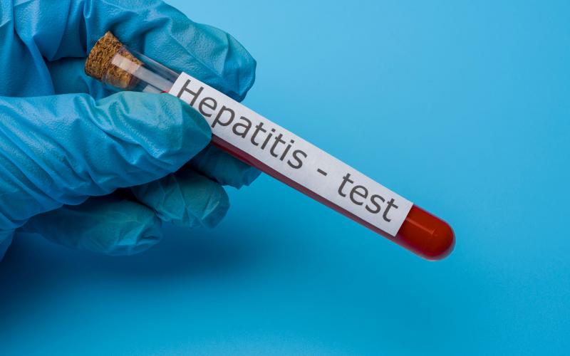  El estado de Veracruzano permanece en el segundo lugar en hepatitis “A” y quinto en Varicela