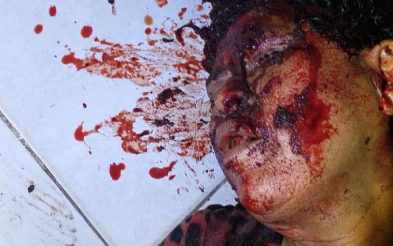 Una mujer fue fuertemente golpeada por su compañera de fiesta en un pantano de Cosoleacaque