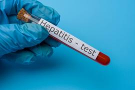  El estado de Veracruzano permanece en el segundo lugar en hepatitis “A” y quinto en Varicela