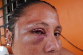  Mujer realiza señalamientos contra la Fuerza Civil por agresiones físicas