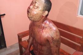 Fallece hombre después de ser macheteado cuando dormía en Nopalapan