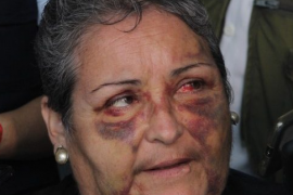 Mujer pide justicia tras agresiones por ex jugador de los Tiburones Rojos de Veracruz